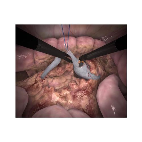 APEX PRO Conjunto de entrenamiento especializado &ndash; Cirug&iacute;a pedi&aacute;trica (Licencia perpetua), 1027067, Laparoscopy Training