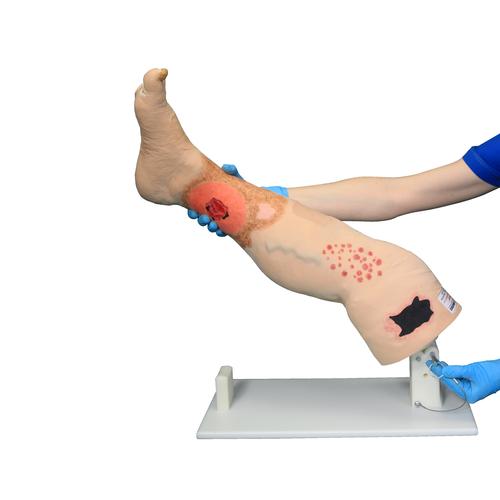 Vinnie Venous Insufficiency Leg&nbsp;, 1022185 [3001176], Adult Patient Care