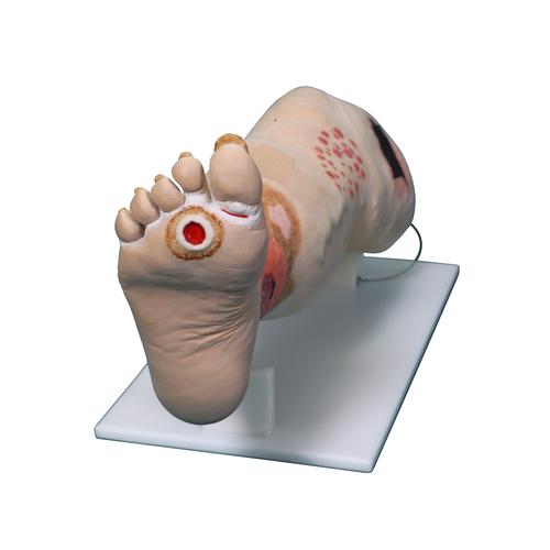 Vinnie Venous Insufficiency Leg&nbsp;, 1022185 [3001176], Adult Patient Care
