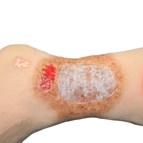 Vinnie Venous Insufficiency Leg&nbsp;, 1022185 [3001176], Adult Patient Care