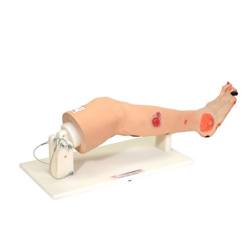 Annie Arterial Insufficiency Leg, 1022186 [3001177], Adult Patient Care