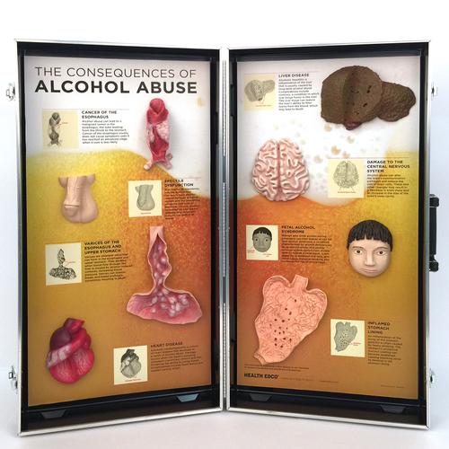 Alcohol Abuse Consequences 3-D Display, 3011542, Drug and Alcohol Education