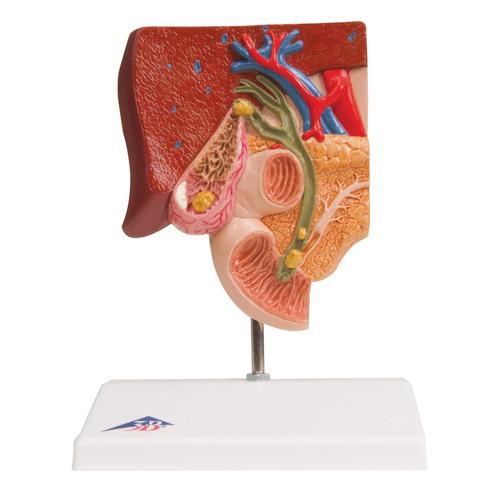 Gallbladder Set, 8000884 [3011910], Anatomy Sets