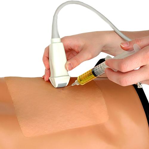Blue Phantom Chest Tube and Ultrasound Guided Thoracentesis Model, 3012463, Ultrasound Skill Trainers