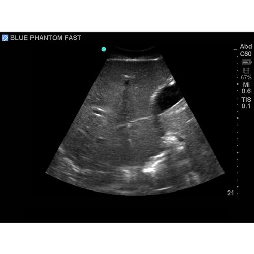 Blue Phantom FAST, TEE and TTE Training Model, 3012469, Transesophageal Echocardiography (TEE)