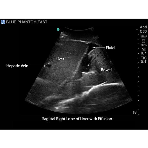 Blue Phantom FAST Ultrasound Training Model Includes Full Body Torso, 3012470, Ultrasound Skill Trainers