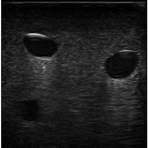 Blue Phantom Gen II PICC with I.V. and Arterial Line Ultrasound Training Model, 3012493, Ultrasound Skill Trainers