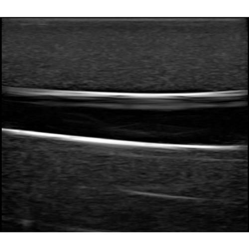 Blue Phantom Gen II PICC with I.V. and Arterial Line Ultrasound Training Model, 3012493, Ultrasound Skill Trainers