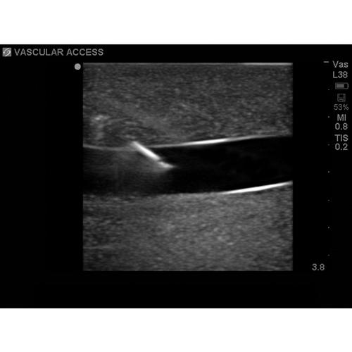 Blue Phantom Internal Jugular Central Line Ultrasound Manikin, 3012495, Ultrasound Skill Trainers