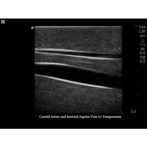 Blue Phantom Internal Jugular Central Line Ultrasound Manikin, 3012495, Ultrasound Skill Trainers