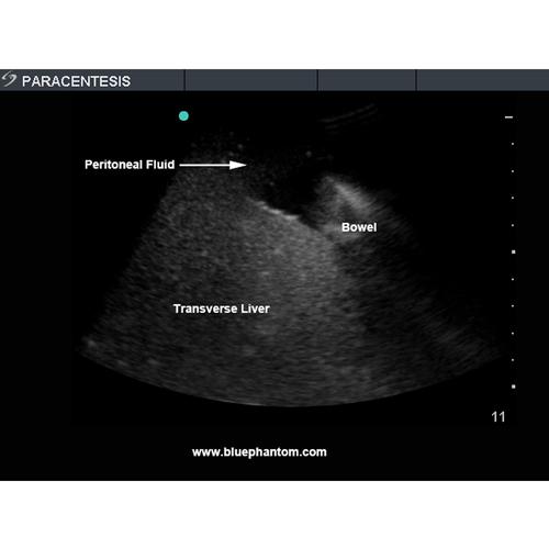 Blue Phantom Paracentesis Ultrasound Training Module with Femoral Nerves and Vessels, 3012500, Ultrasound Skill Trainers