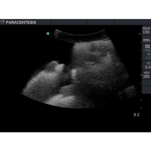 Blue Phantom Paracentesis Ultrasound Training Module with Femoral Vessels, 3012501, Ultrasound Skill Trainers