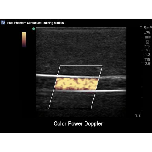 Blue Phantom Peripheral Doppler Ultrasound Training Model, 3012503, Ultrasound Skill Trainers