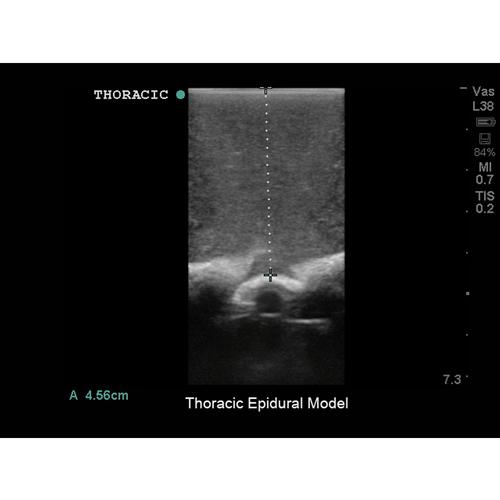 Blue Phantom Spinal Epidural and Lumbar Puncture Training Model, 3012516, Ultrasound Skill Trainers