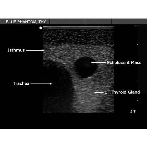 Blue Phantom Thyroid Biopsy Ultrasound Training Model | 3012518 | Blue ...