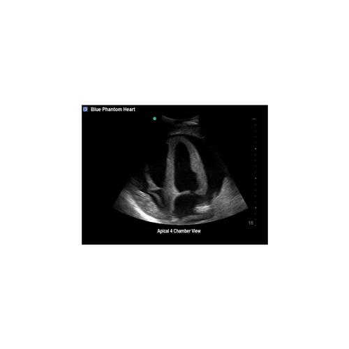 Blue Phantom Transthoracic Echocardiography and Pericardiocentesis Ultrasound Training Model, 3012521, Transesophageal Echocardiography (TEE)