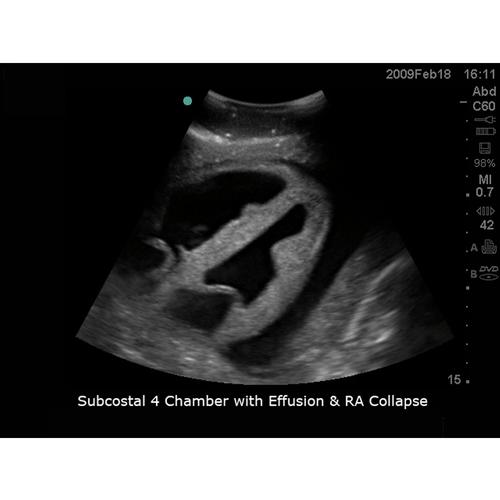 Blue Phantom TTE Ultrasound Training Platform Without optional Head, 3012528, Transesophageal Echocardiography (TEE)