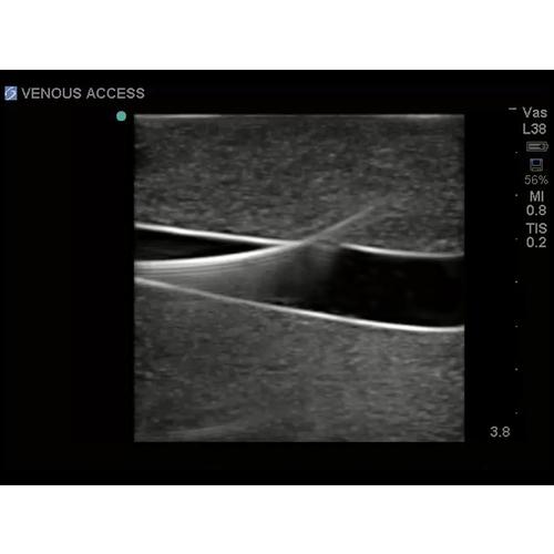 Blue Phantom Femoral Vascular Access Replacement Tissue w/ DVT for BPP-031 to BPP-036, 3012554, Ultrasound Skill Trainers