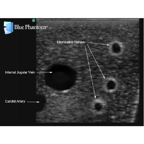 Blue Phantom Gen I Regional Anesthesia and Central Venous Access Ultrasound Replacement Tissue, 3012572, Ultrasound Skill Trainers