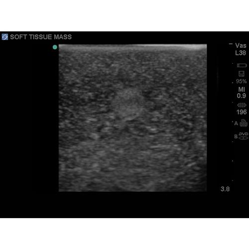 Blue Phantom Leg Tissue Insert for Soft Tissue Mass Biopsies used with Model BPP-070, 3012576, Ultrasound Skill Trainers