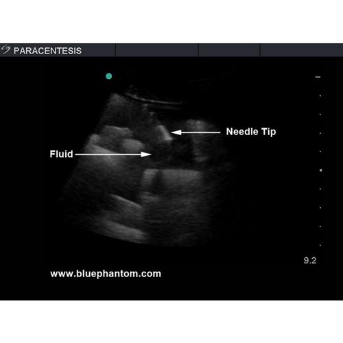 Blue Phantom Paracentesis Ultrasound Replacement Tissue Insert, 3012583, Ultrasound Skill Trainers