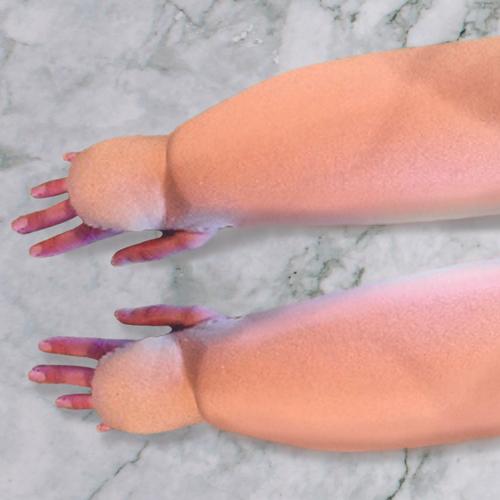 Lymphedema Simulation Arm Sleeves (ADULT) - Pair of 2ea - Beige, 3017843, Obesity Simulation Suits