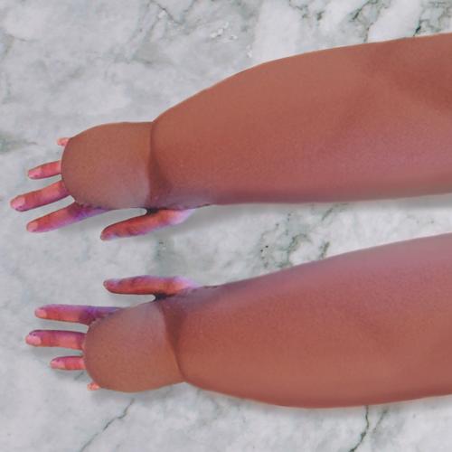 Lymphedema Simulation Arm Sleeves (ADULT) - Pair of 2ea - Dark, 3017844, Obesity Simulation Suits