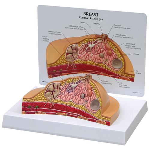 3B Breast Cancer Diagnosis Educator's Package, 3018061, Simulation Kits