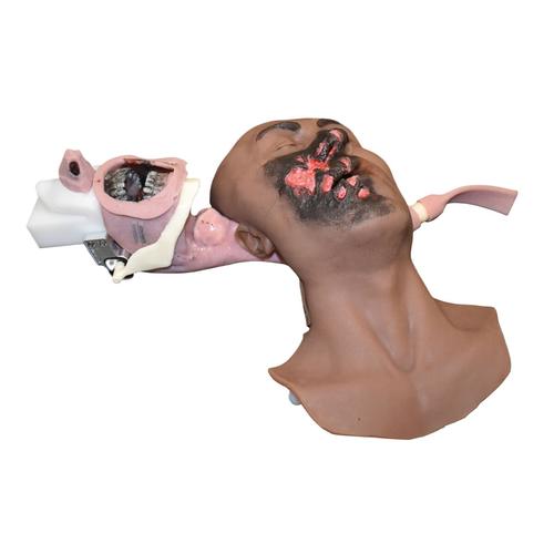 Kit d'apprentissage des soins &agrave; une victime de br&ucirc;lures afro-am&eacute;ricaine, 1026950 [3018418], Prise en charge respiratoire du patient adulte