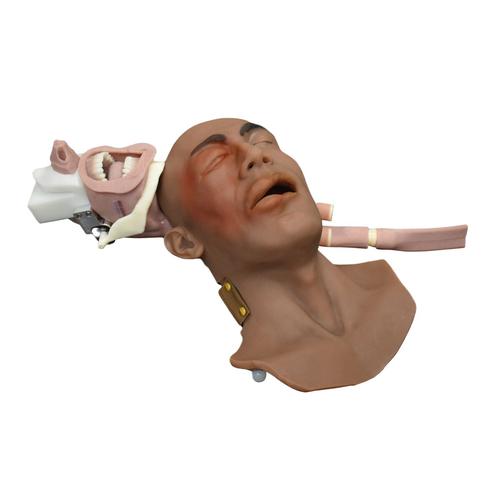 Kit de Habilidades para Paciente com Edema &ndash; Afrodescendente, 1026952 [3018459], Gest&atilde;o das vias a&eacute;reas adulto
