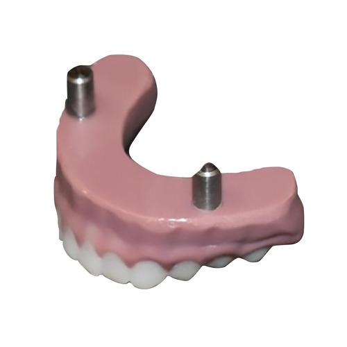 Dientes inferiores pedi&aacute;tricos, 1026944 [3018461], Repuestos