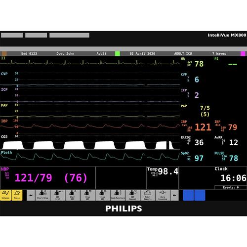 Philips IntelliVue MX800 가상 제세동기 / 환자감시장치 시뮬레이터 스크린 Philips IntelliVue MX800 Patient Monitor Screen Simulation for REALITi360, 8000974, 모니터