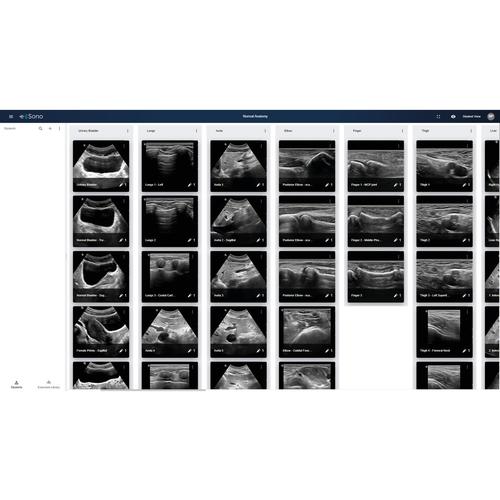Simulatore di ecografia e Sono - Licenza annuale, 200 utenti, 8001207, Ultrasound Simulation Software