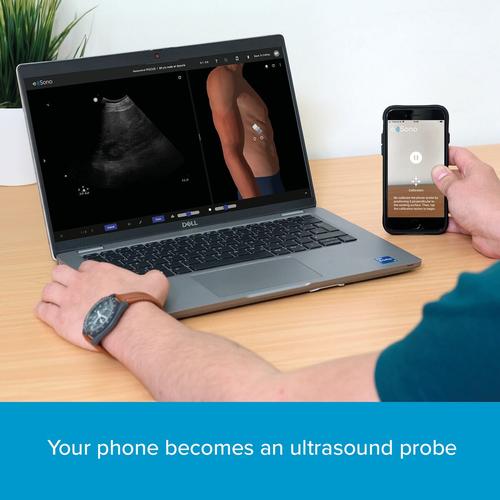 e Sono Abdominal POCUS - Multiuser License, 8001268, Online Ultrasound POCUS Courses