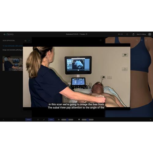 e Sono Ecograf&iacute;a Abdominal &ndash; Licencia Individual, 8001269, Licencias Individuales De Los Cursos e Sono