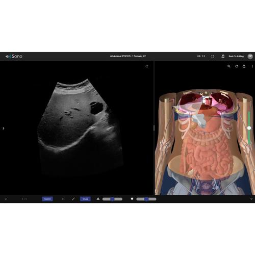 e Sono Abdominal POCUS &ndash; Single User License, 8001269, e Sono Courses Individual Licenses