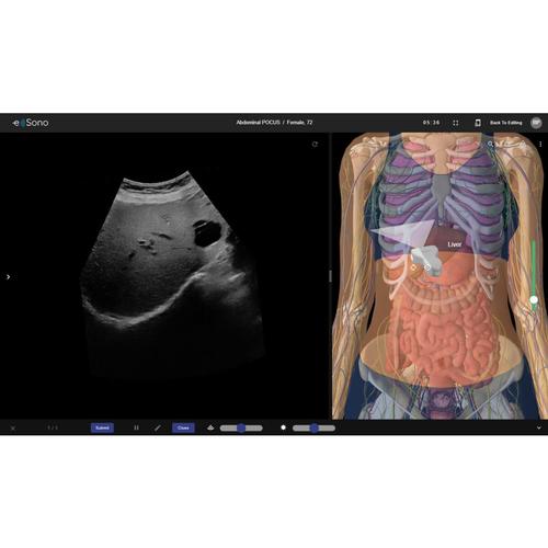 e Sono Abdominal POCUS &ndash; Single User License, 8001269, e Sono Courses Individual Licenses