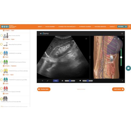 POCUS E-Sim Complete da GUSI & e Sono &ndash; Licen&ccedil;a individual, 8001276, Licen&ccedil;as Individuais Dos Cursos e Sono