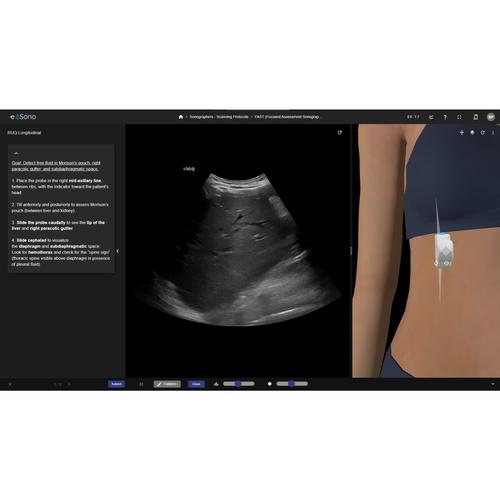 e Sono Sonographers Course - Single User License, 8001426, e Sono Courses Individual Licenses