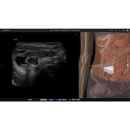 e Sono Sonographers Course - Single User License, 8001426, e Sono Courses Individual Licenses