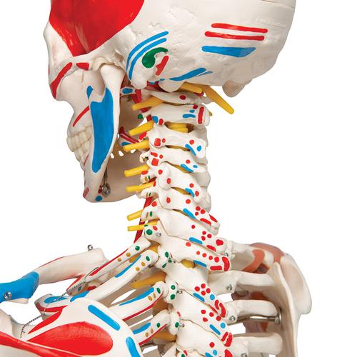 İskelet Sam A13 - 5 tekerlekli metal ayak üzerinde lüks versiyon - 3B Smart Anatomy, 1020176 [A13], Iskelet Modelleri - Gerçek Boy