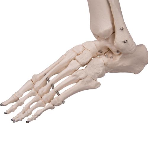 Menschliches Skelett Modell "Fred", lebensgro&szlig; mit flexibler einstellbarer Wirbels&auml;ule mit Nerven, Arterien & Bandscheibenvorfall, auf Metallstativ mit Rollen, 1020178 [A15], Skelette lebensgro&szlig;