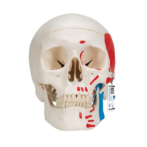 하악노출, 채색된 두개골모형, 3파트 분리형 Classic Human Skull Model painted, 3 part - 3B Smart Anatomy, 1020168 [A23], 두개골 모형