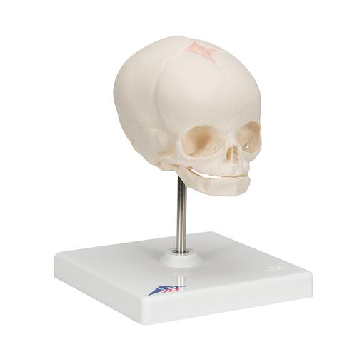 임신 30주째 태아 두개골(머리뼈)모형, 받침대포함  Foetal Skull Model, natural cast, 30th week of pregnancy, on stand - 3B Smart Anatomy, 1000058 [A26], 두개골 모형