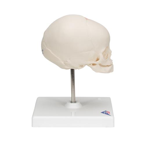 Cr&aacute;neo de feto, sobre soporte, 1000058 [A26], Modelos de Cr&aacute;neos Humanos