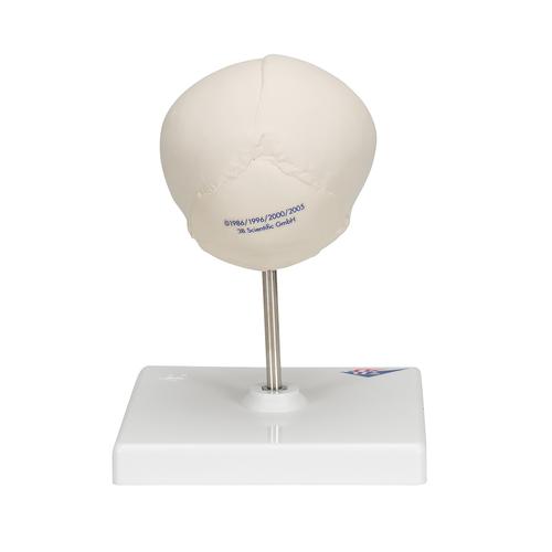 Fetus Sch&auml;del Modell, auf Stativ, 1000058 [A26], Sch&auml;delmodelle