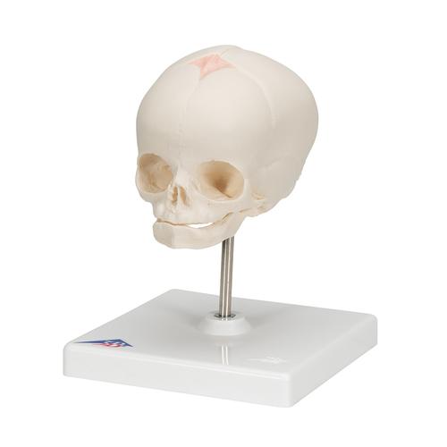 Fetus Sch&auml;del Modell, auf Stativ, 1000058 [A26], Sch&auml;delmodelle