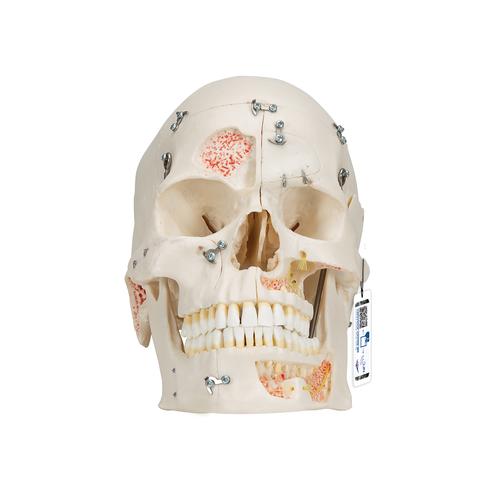 Deluxe Human Demonstration Dental Skull Model, 10 part - 3B Smart Anatomy, 1000059 [A27], Human Skull Models