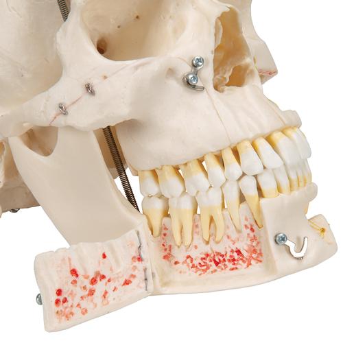 豪华版牙科示范颅骨模型，10部分 - 3B Smart Anatomy, 1000059 [A27], 头颅模型