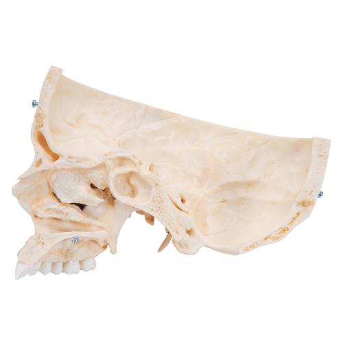실제 뼈와 유사한 조직으로 제작한 두개골 모형, 6 파트 BONElike Human Bony Skull Model, 6 part - 3B Smart Anatomy, 1000062 [A281], 두개골 모형